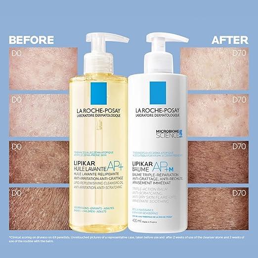 La Roche Posay Face Cream & Body Lotion BUNDLE, Toleriane Dermallergo Creme & Lipikar Baume AP+M, Your Sensitive Skin Hydration Duo, Suitable for Sensitive, Dry to Very Dry Skin, Fragrance-Free - Which Mark