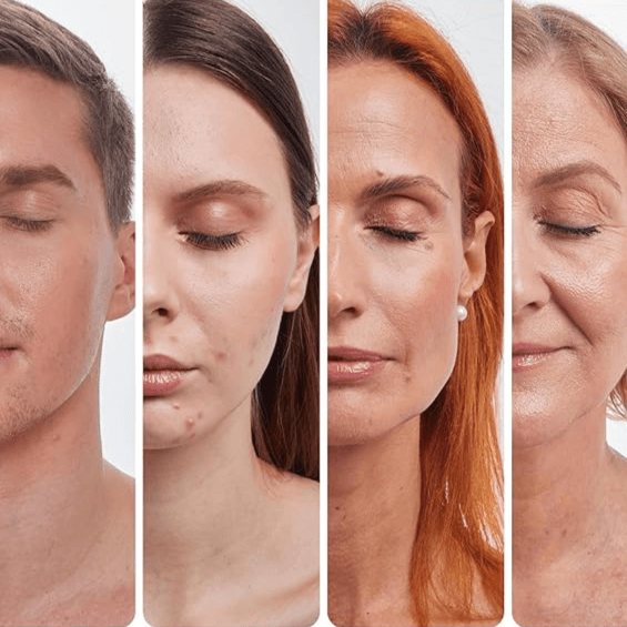 Anti Aging - Which Mark