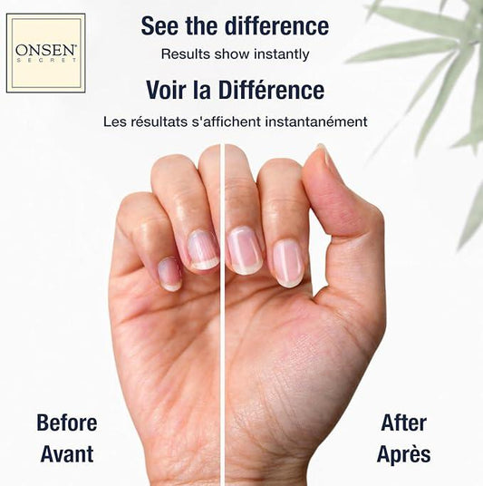 Onsen Cuticle Cream, Cuticle Oil in Deep Action - Japanese Natural Minerals Nail Care Serum and Butter, Soothe, and Strengthen Cuticles and Nails, Visible Results, Non-Greasy - 15ml - Which Mark