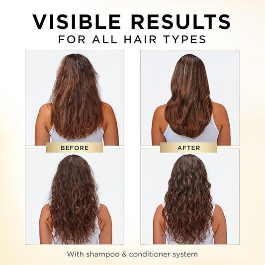 Pantene Shampoo 820 mL, Conditioner 745 mL and Hair Treatment Set 15 mL, Daily Moisture Renewal For Dry Hair, Safe For Color-Treated Hair, 1.58 L Total - Which Mark