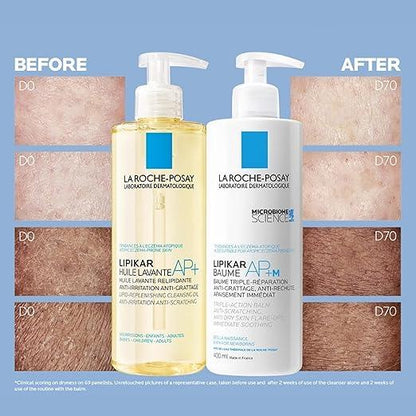 La Roche Posay Face Cream & Body Lotion BUNDLE, Toleriane Dermallergo Creme & Lipikar Baume AP+M, Your Sensitive Skin Hydration Duo, Suitable for Sensitive, Dry to Very Dry Skin, Fragrance-Free - Which Mark