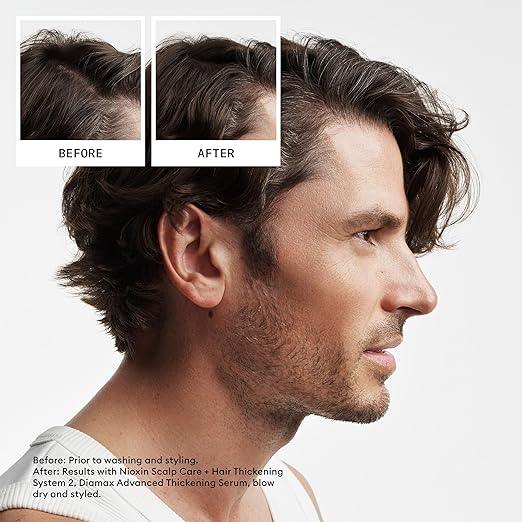 Nioxin Scalp + Hair Thickening System Kits | For Natural, Colored, & Damaged Hair with Light to Progressed Thinning | Strengthen & Boost Hair Density with Niacinamide & Biotin | Trial Size | 1 Month Supply - Which Mark