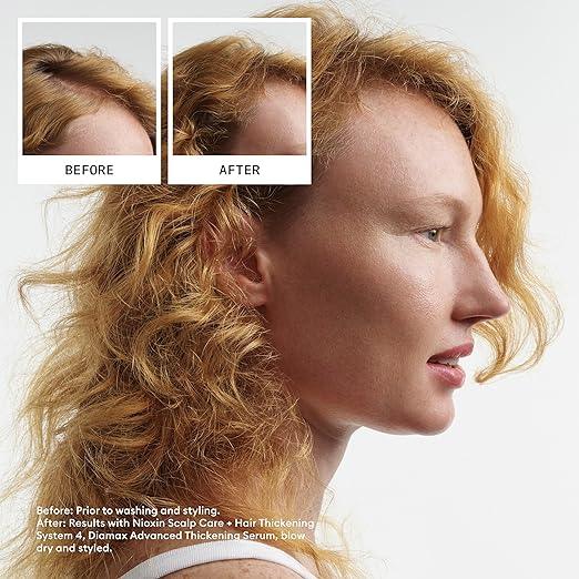 Nioxin Scalp + Hair Thickening System Kits | For Natural, Colored, & Damaged Hair with Light to Progressed Thinning | Strengthen & Boost Hair Density with Niacinamide & Biotin | 3 Month Supply - Which Mark