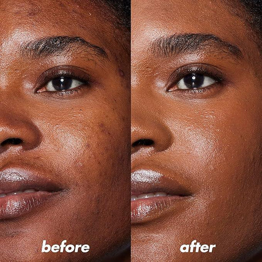e.l.f. Camo Color Corrector, Hydrating & Long-Lasting Color Corrector For Camouflaging Discoloration, Dullness & Redness, Vegan & Cruelty-Free, Orange - Which Mark